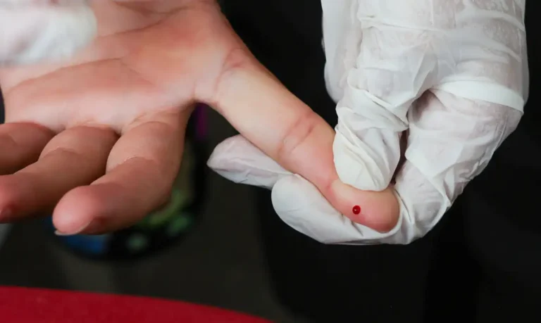 Teste rapido dengue SUS