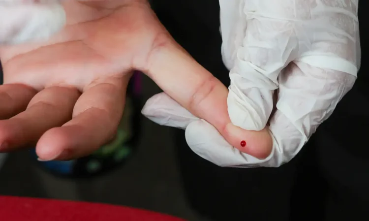 Diagnóstico precoce da Dengue: Teste rápido agora é gratuito no SUS