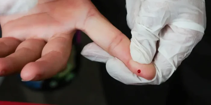 Teste rapido dengue SUS