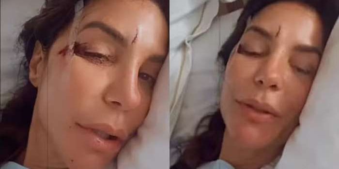 Ivete Sangalo sofre ferimentos leves após acidente em casa e tranquiliza fãs